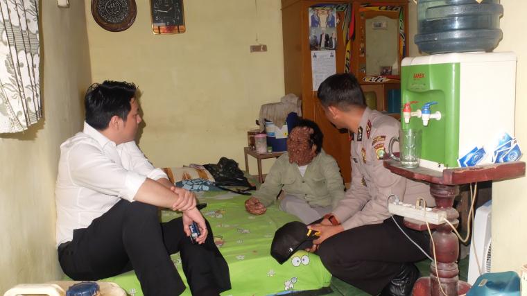 Berharap Dibantu Rano Karno, Urip Pengidap Penyakit Neurofibromatosis Disantuni Pengusaha
